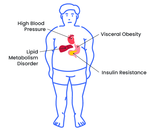 Illustration of the metabolic syndrome and its risk factors