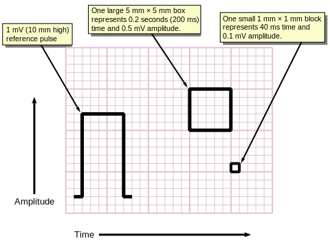 How to measure ECG boxes