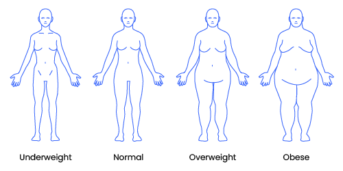 Body shapes of an underweight, normal, overweight, and obese person.