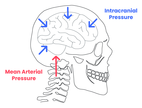 CPP illustration with mean arterial pressure (MAP) and intracranial pressure (ICP).