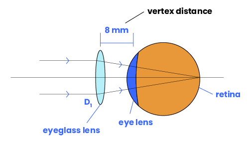 An eyeglass at regular distance focusing an image onto the retina.