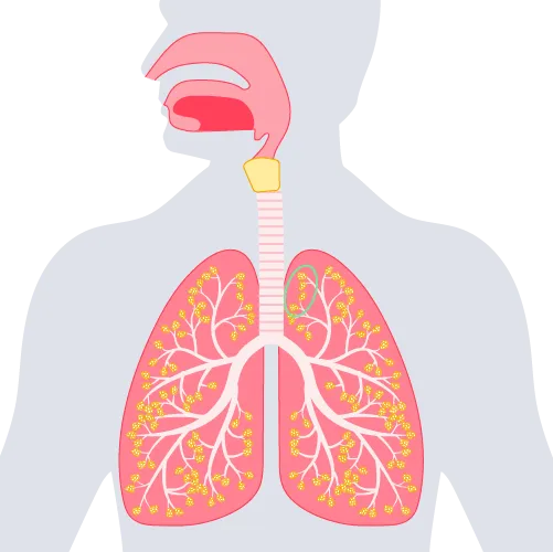 Illustration of the lung with the alveolar dead space circled in in green.