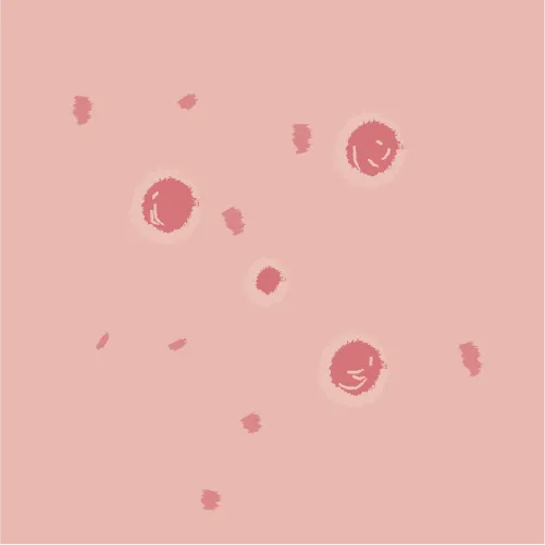 Example of eczema thickness given the intensity score 3