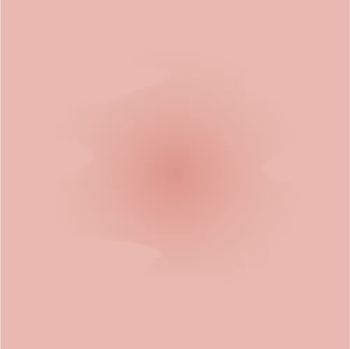 Example of eczema redness given the intensity score 1