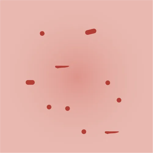 Example of eczema scratching given the intensity score 2