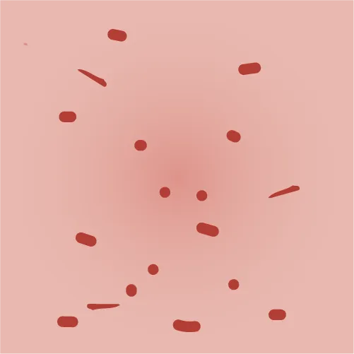 Example of eczema scratching given the intensity score 3