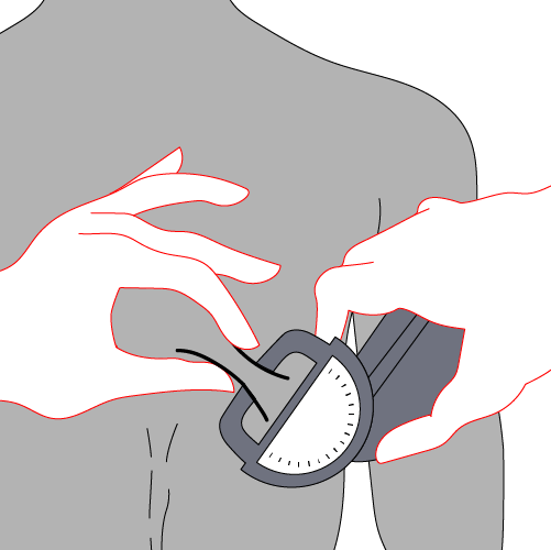 Image showing how to measure subscapular skinfold thickness.