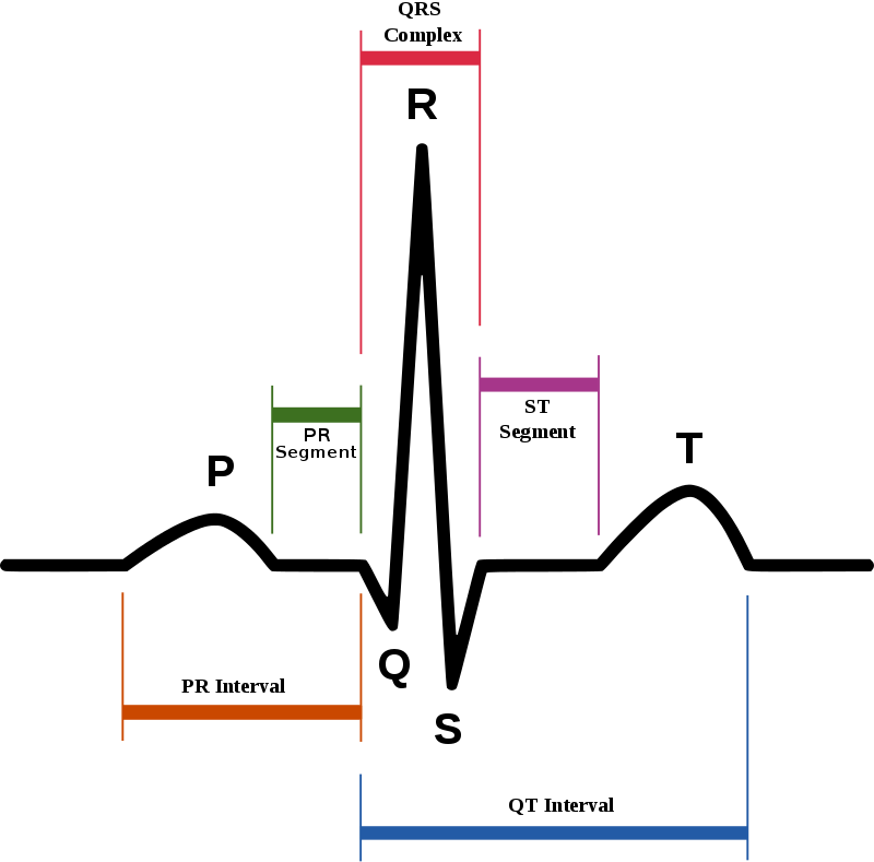 Schematic representation of normal ECG trace, with waves, segments, and intervals labeled