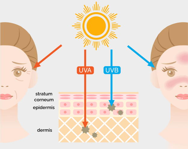 effects of UVA and UVB radiation on the skin